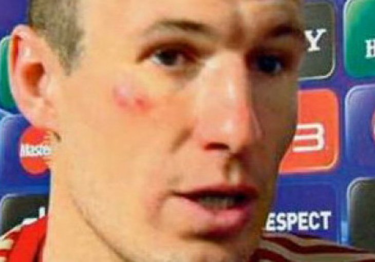 Robben se sjetio Riberyevog šamaranja